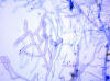 Mycelia sterilia