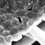 Rhizopus stolonifer Sporen im REM bei 7000-facher Vergrößerung