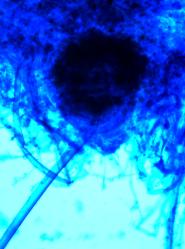 Rhizopus stolonifer Schimmelpilz im Lichtmikroskop bei 400-facher Vergrößerung