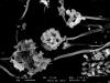 Stachybotrys in verschiedenen Wachstumsphasen im Rasterelektronenmikroskop bei 2920-facher Vergrößerung