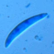 Fusarium culmorum Sporen im Lichtmikroskop bei 400-facher Vergrößerung
