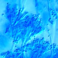 Penicillium chrysogenum Schimmelpilz im Lichtmikroskop bei 400-facher Vergrößerung
