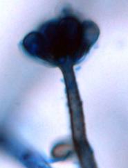 Stachybotrys chartarum (atra) im Lichtmikroskop
