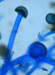 Syncephalastrum racemosum Schimmelpilz im Lichtmikroskop bei 400-facher Vergrößerung